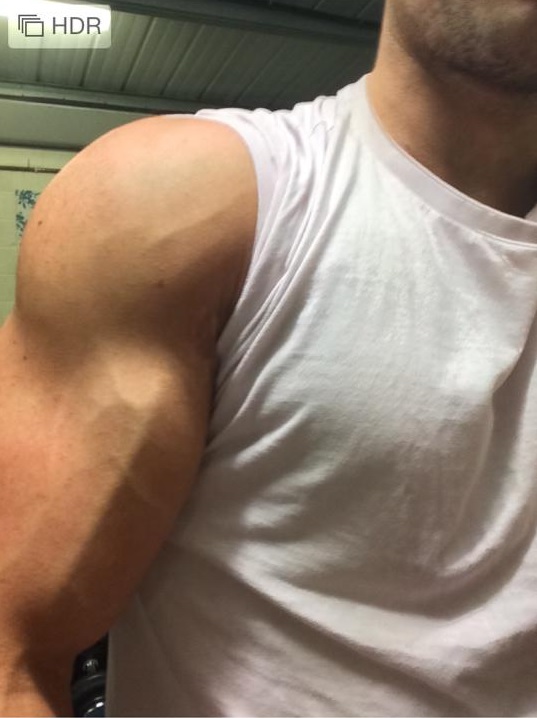 vascularity