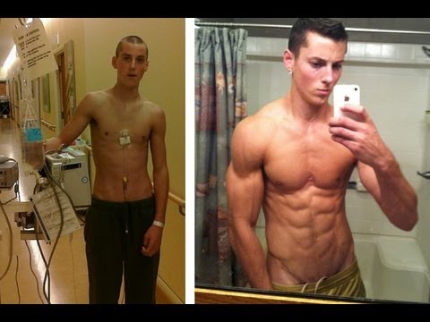 cancer patient bodybuilder