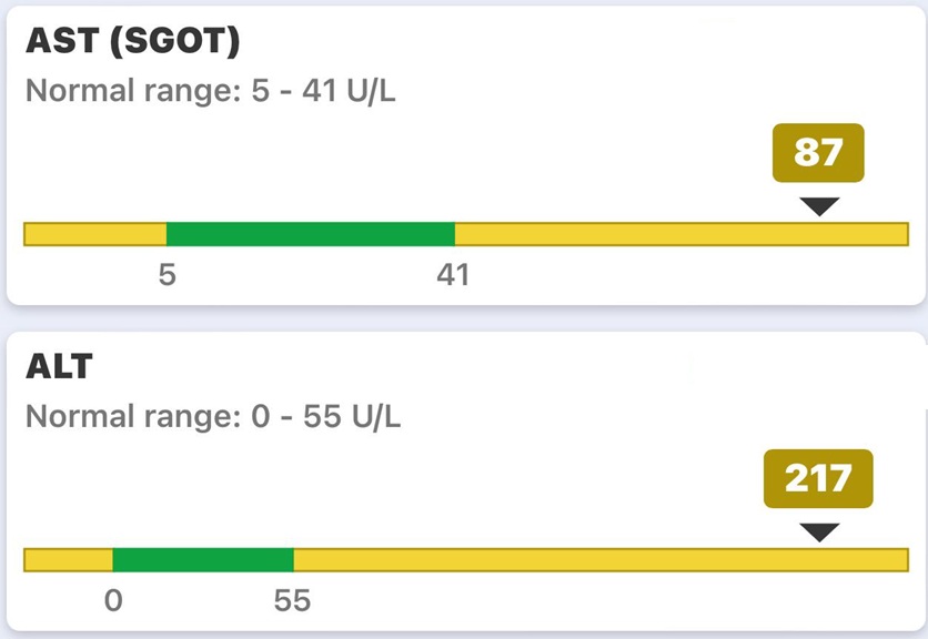 Liver function test results 