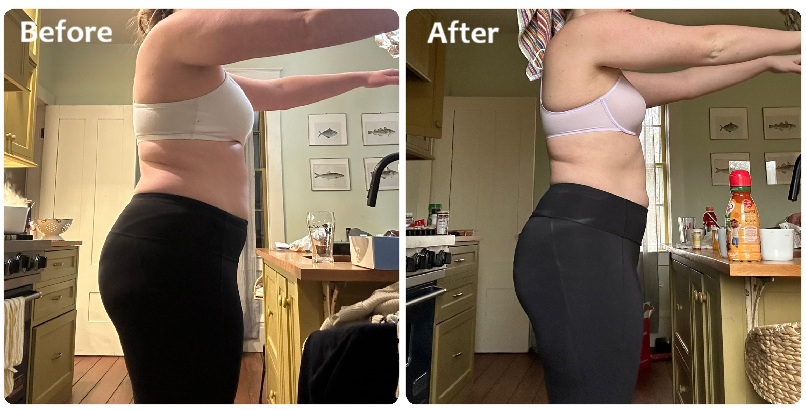 semaglutide before and after transformation